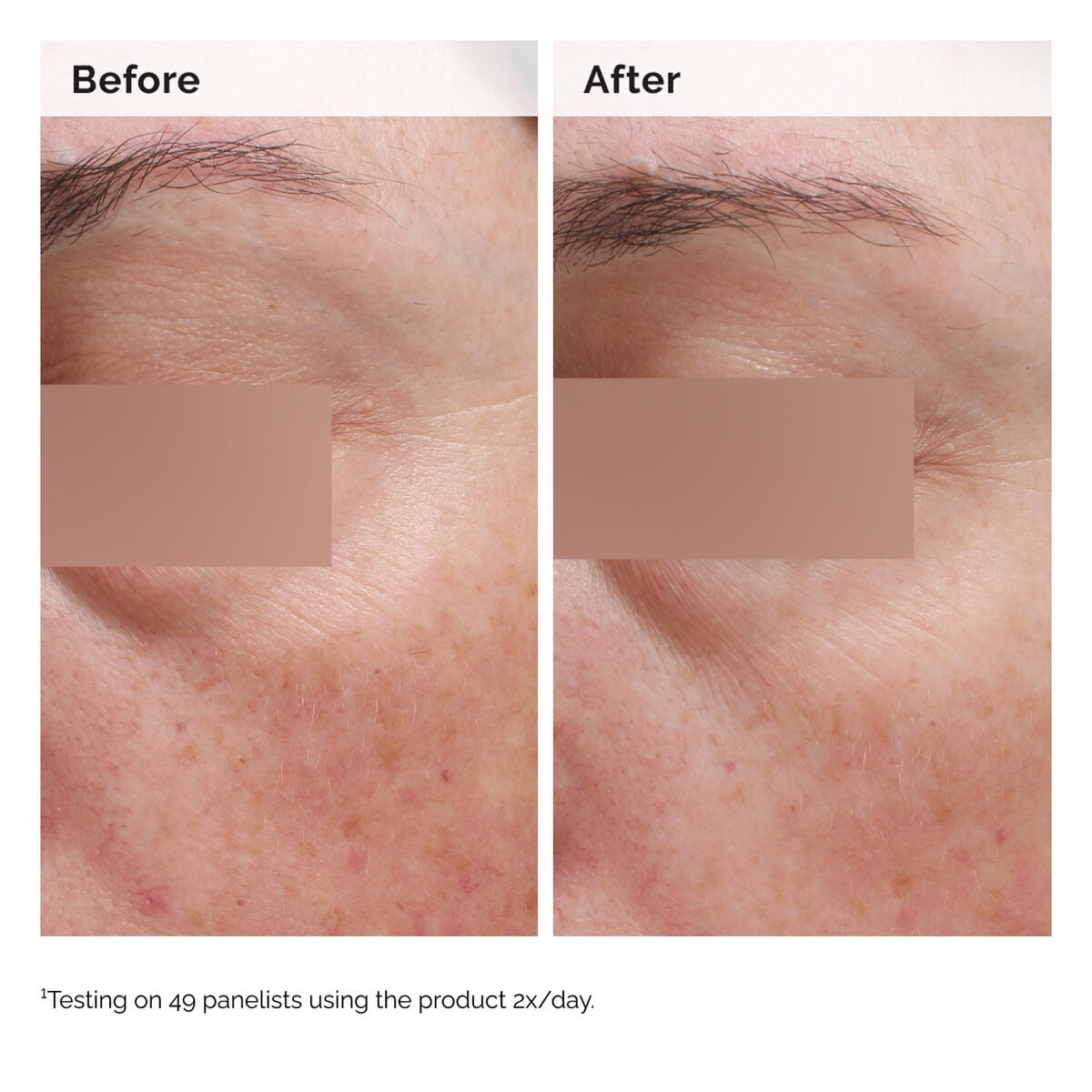 niacinamide-5-face-and-body-emulsion-w4 2024-08-23-ORD-Nia-5pct-Face-Body-B-A-Elasticity-Global-02-1x1.jpg