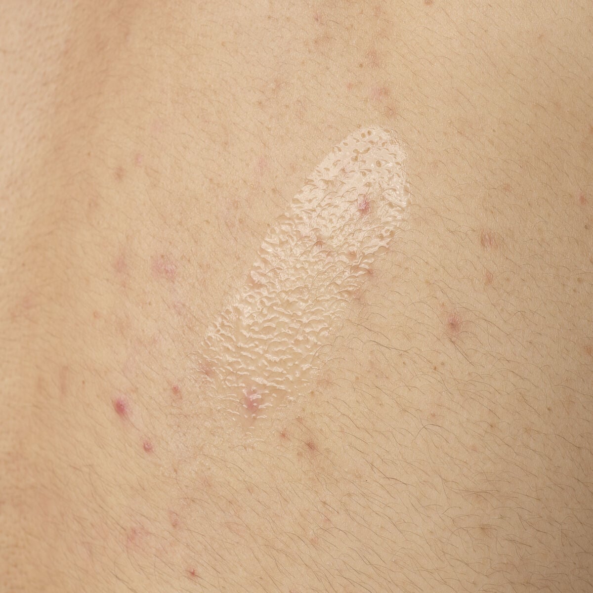 salicylic-acid-0-5-body-serum-m1 ORD-salicylic-acid-05-body-240ml-application.jpg