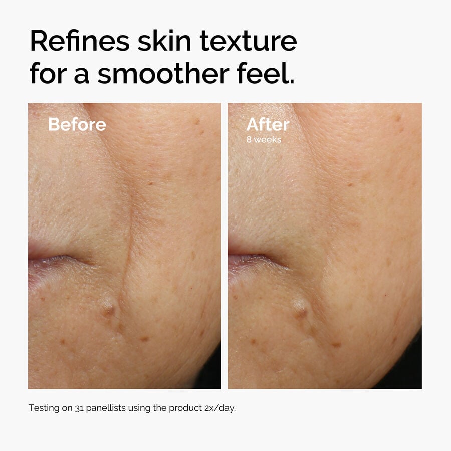 caffeine-3-escin-1-face-serum-r5 ord-caffeine-3pct-escin-1pct-face-serum-before-after-texture.jpg