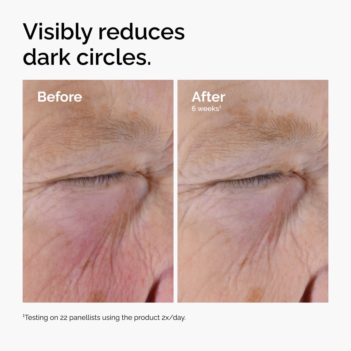 caffeine-solution-5-egcg-eye-serum-w9 ord-caffeine-solution-egcg-dark-circles-before-after.jpg