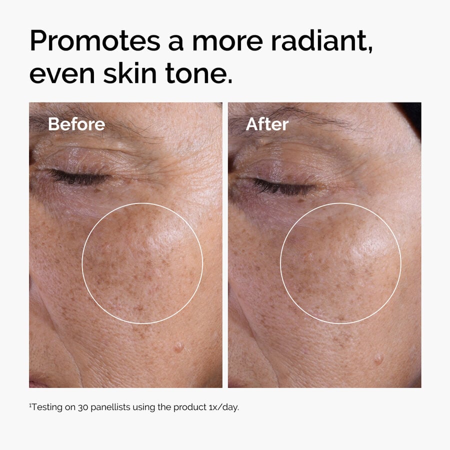 glycolic-acid-7-exfoliating-toner-f8 ord-glycolic-before-after-radiance.jpg
