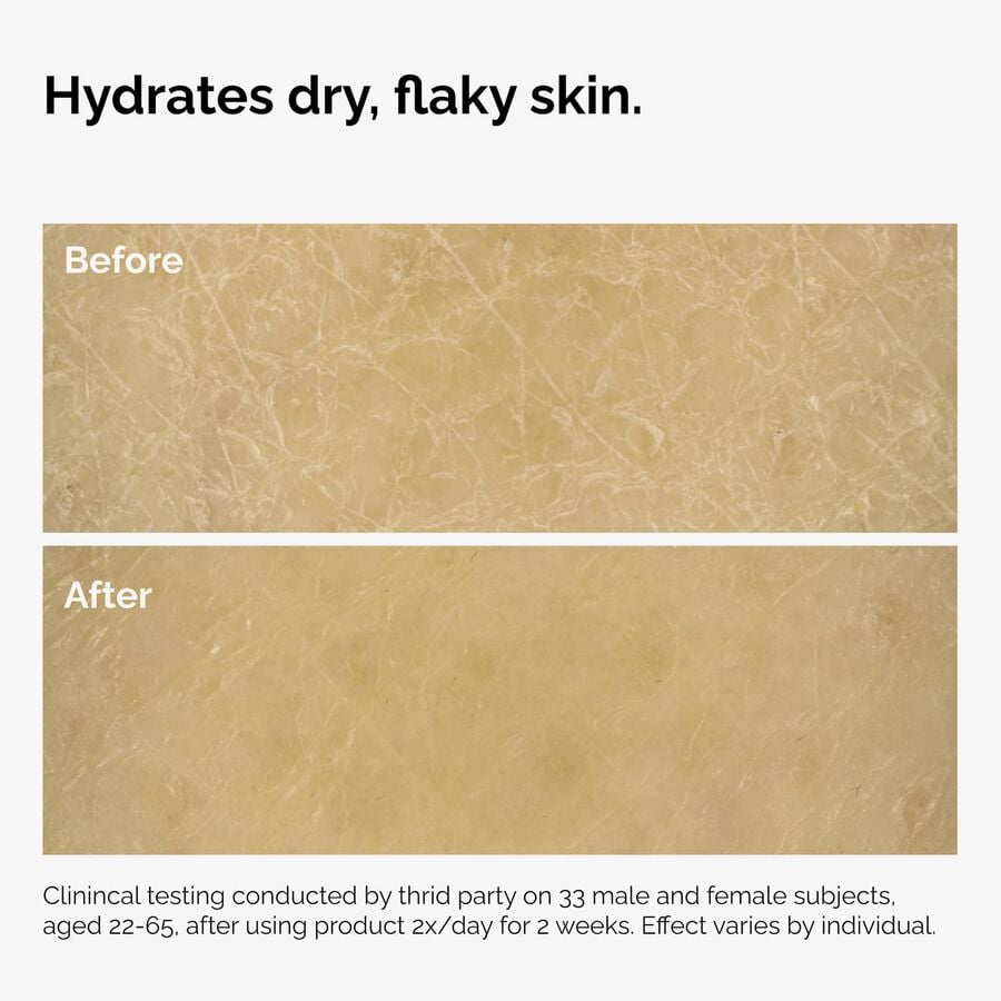 the-body-care-collection-i0 ord-natural-moisturizing-factors-inulin-body-before-after-graphic-02.jpg
