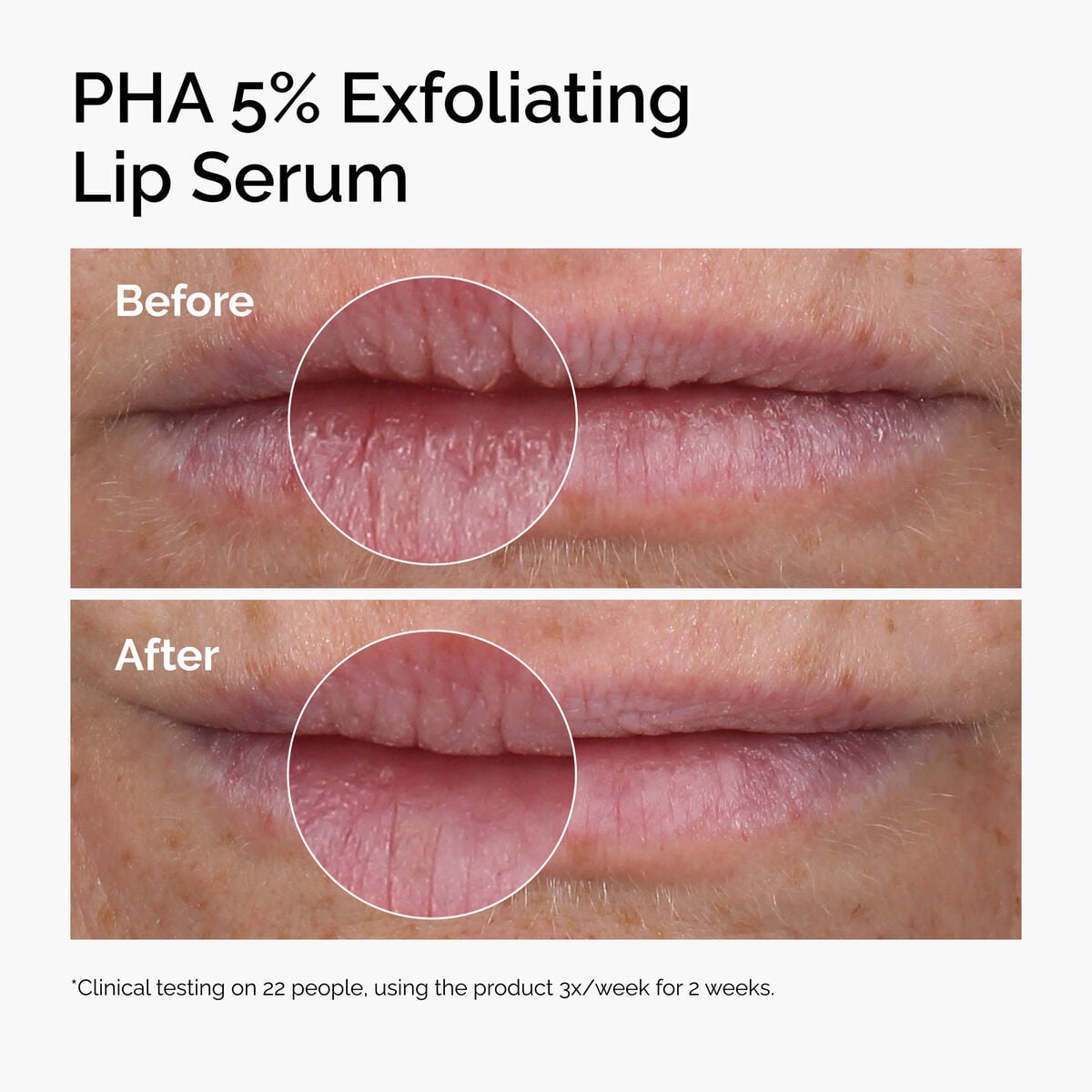 pha-5-exfoliating-lip-serum-a7 ord-pha-5pct-lip-exfoliating-serum-before-after.jpg
