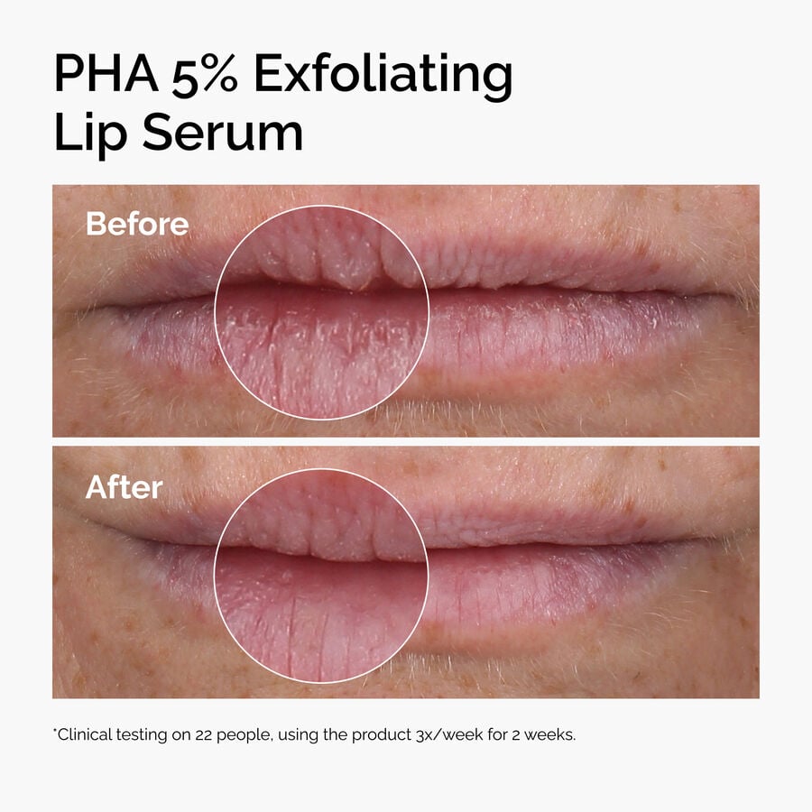 pha-5-exfoliating-lip-serum-a7 ord-pha-5pct-lip-exfoliating-serum-before-after.jpg