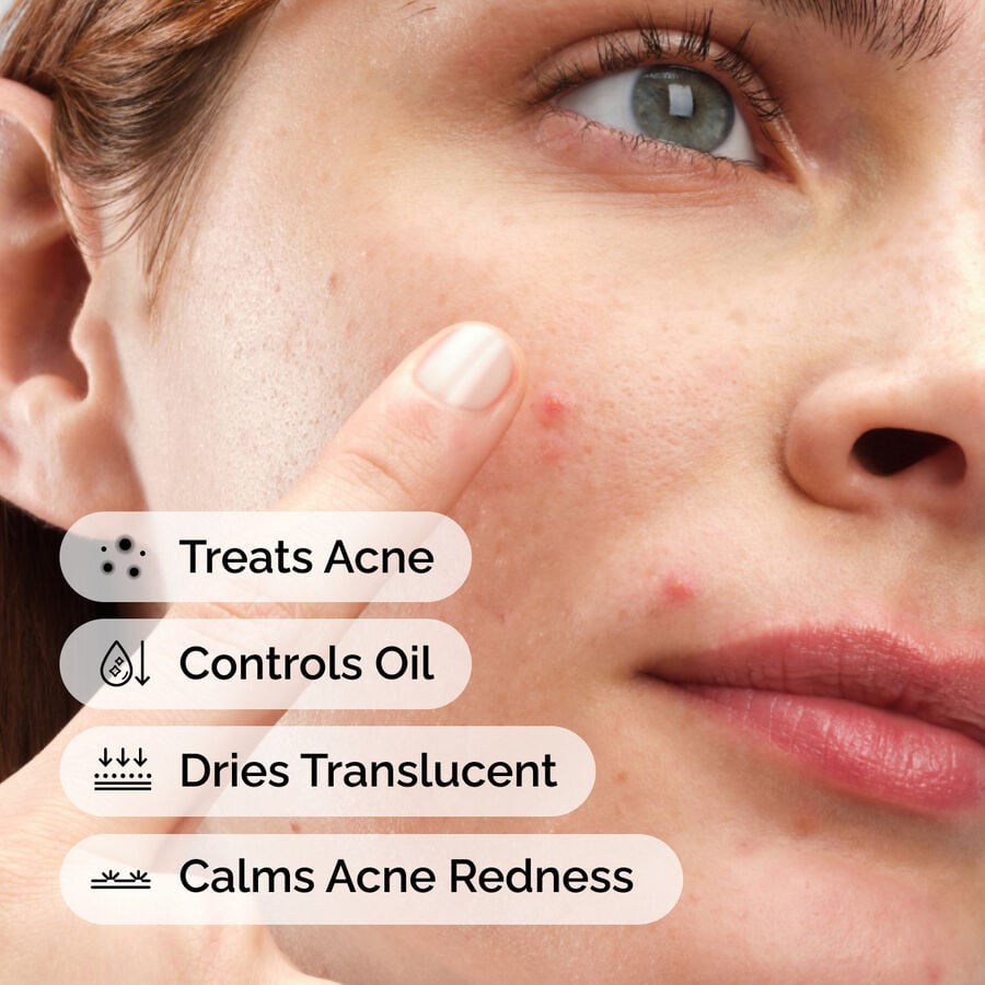 sulfur-10-powder-to-cream-concentrate-m6 ord-sulfur-10pct-powder-to-cream-concentrate-model-application-with-benefits-acne.jpg